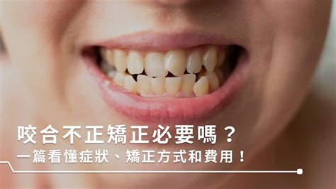 下排牙齒歪斜|咬合不正是什麼？臉歪、下巴後縮該怎麼辦？